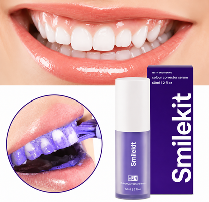 2 Smilekit BLANQUEADOR DENTAL