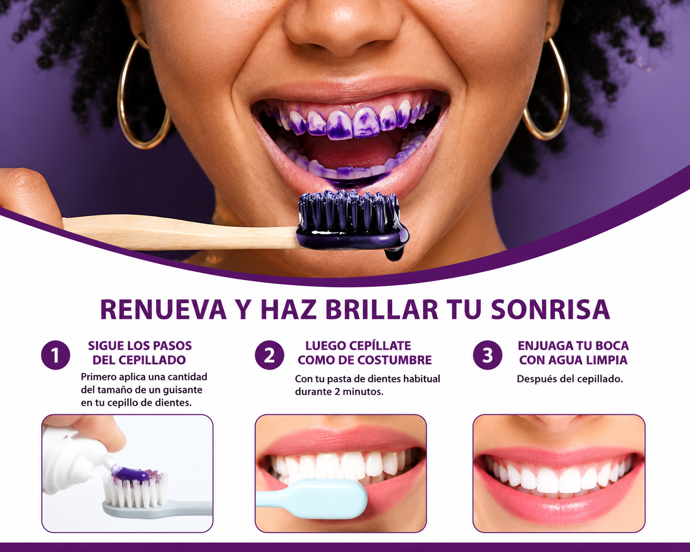 2 Smilekit BLANQUEADOR DENTAL