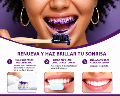 2 Smilekit BLANQUEADOR DENTAL