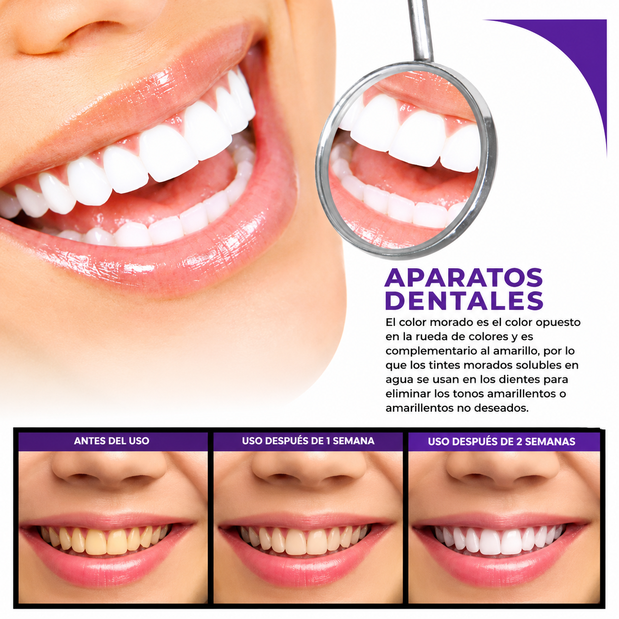 2 Smilekit BLANQUEADOR DENTAL