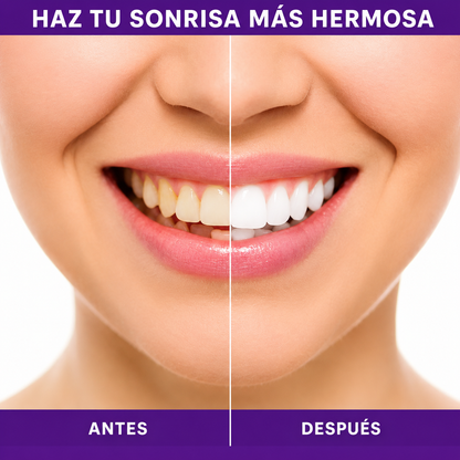 2 Smilekit BLANQUEADOR DENTAL